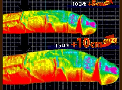 ペニス増大のサーモグラフィー画像